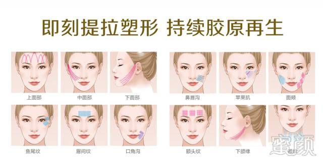 https://img.miyanlife.com/mnt/timg/190304/12504543R-3.jpg