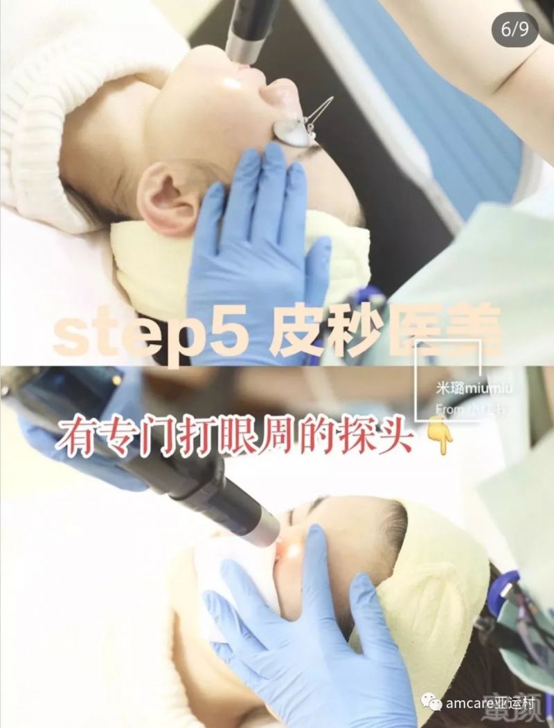 https://img.miyanlife.com/mnt/timg/190304/12544B5L-1.jpg