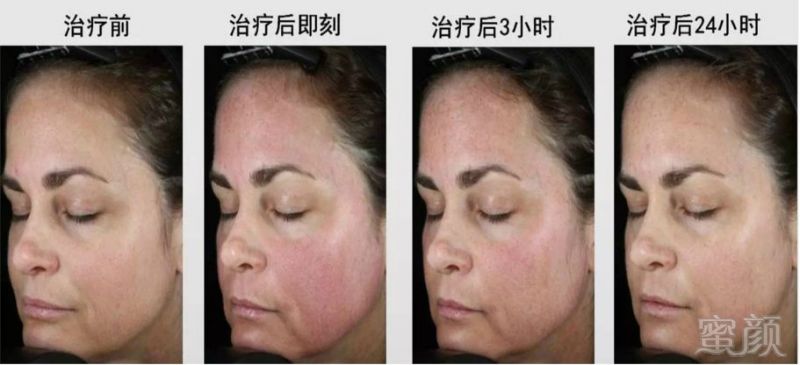 https://img.miyanlife.com/mnt/timg/190304/12564210E-8.jpg