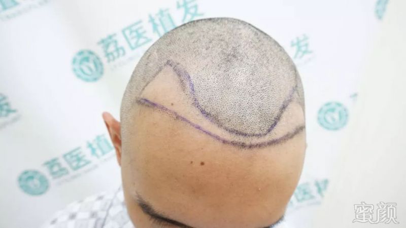 https://img.miyanlife.com/mnt/timg/190304/1304092122-0.jpg