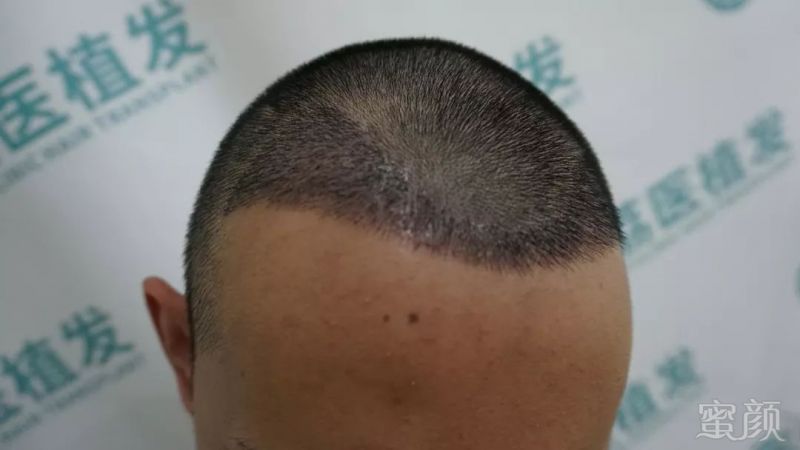 https://img.miyanlife.com/mnt/timg/190304/1304104920-6.jpg