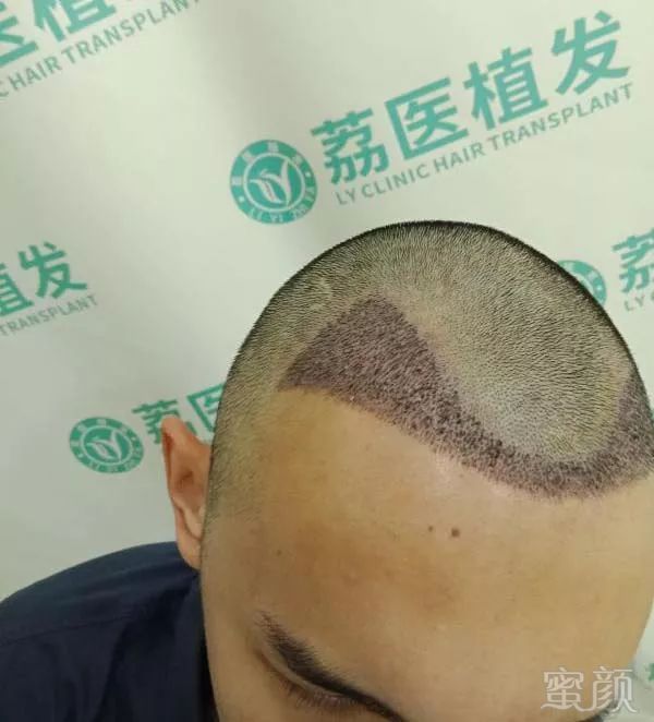 https://img.miyanlife.com/mnt/timg/190304/13041050A-5.jpg