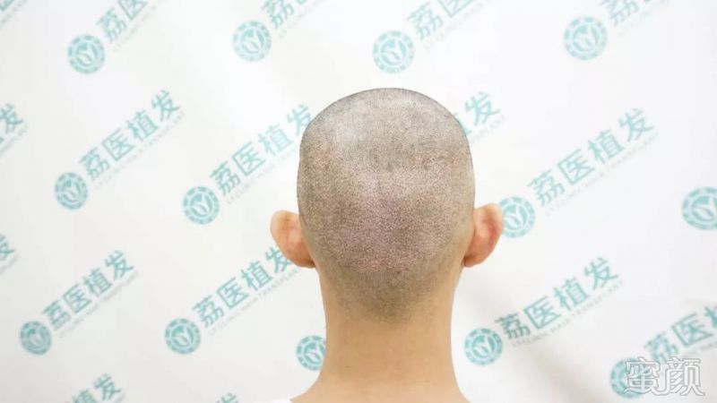 https://img.miyanlife.com/mnt/timg/190304/1304105B2-4.jpg