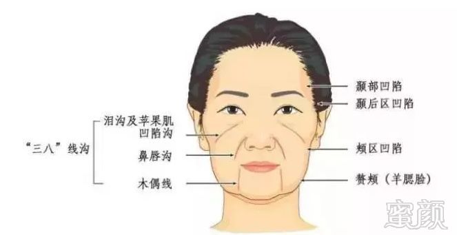 https://img.miyanlife.com/mnt/timg/190304/13453J222-1.jpg
