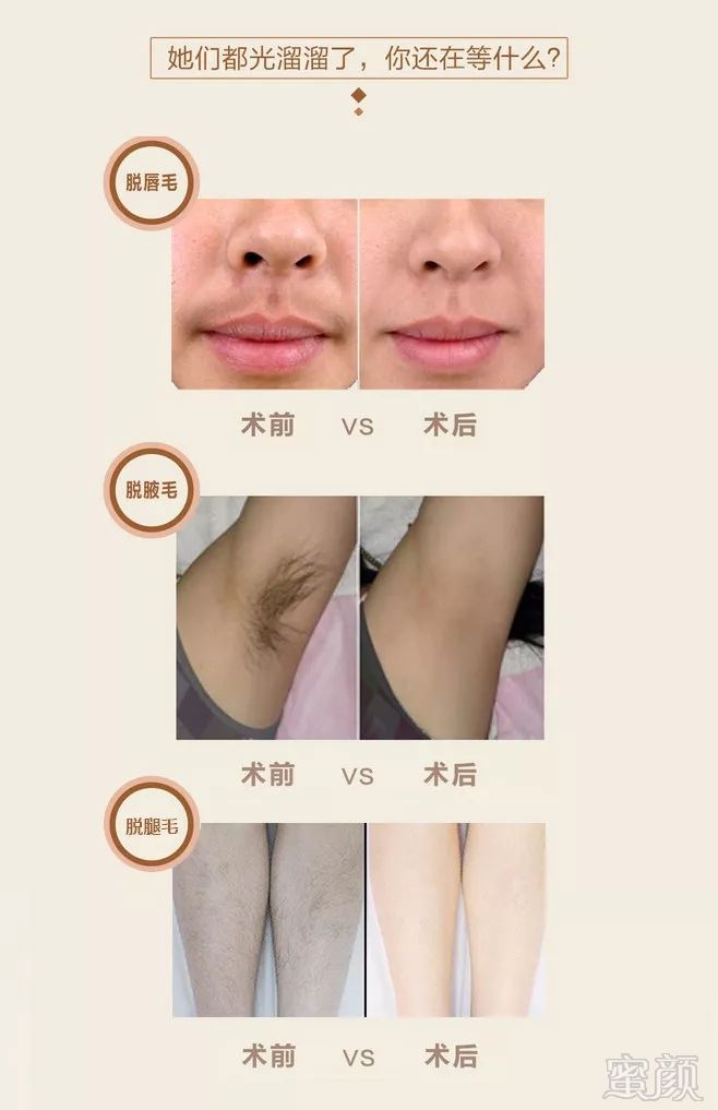 https://img.miyanlife.com/mnt/timg/190304/1403112Q4-6.jpg