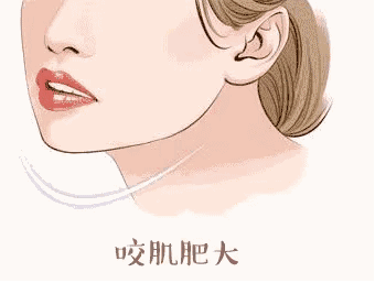 https://img.miyanlife.com/mnt/timg/190304/1414594C8-2.jpg