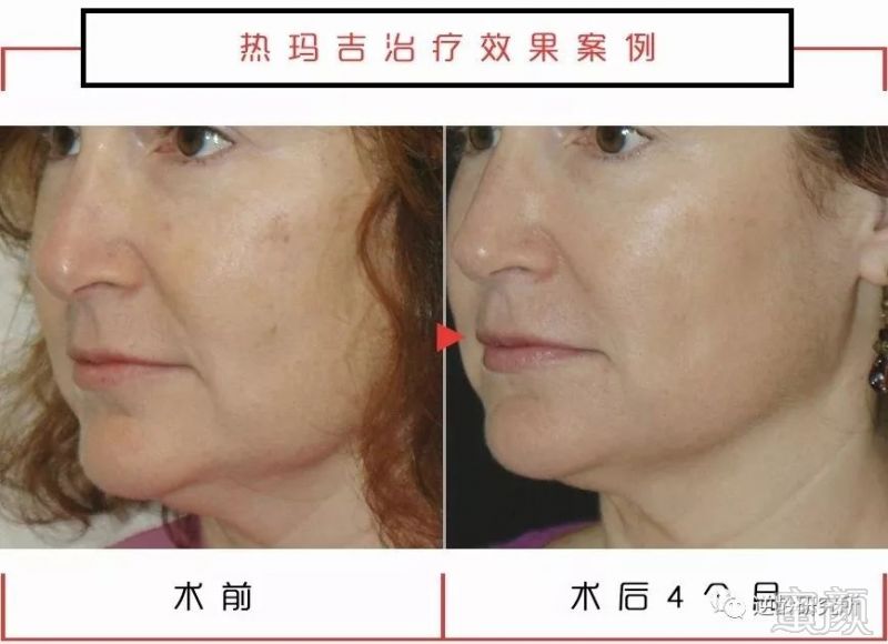 https://img.miyanlife.com/mnt/timg/190305/1230163196-5.jpg