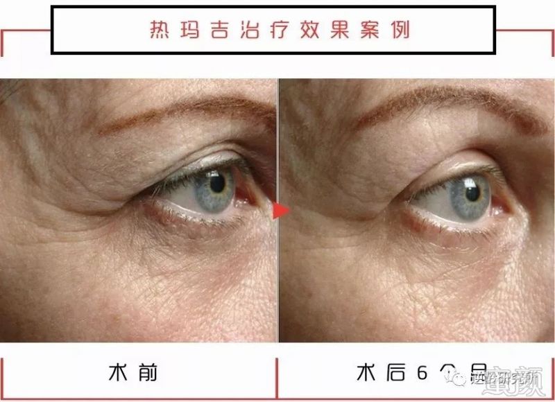 https://img.miyanlife.com/mnt/timg/190305/12301A4Z-6.jpg