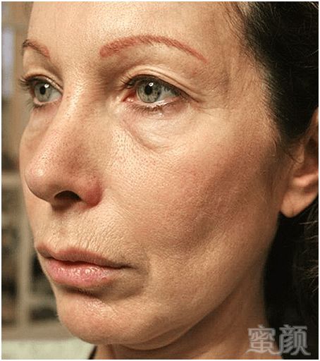 https://img.miyanlife.com/mnt/timg/190305/1233336359-11.jpg