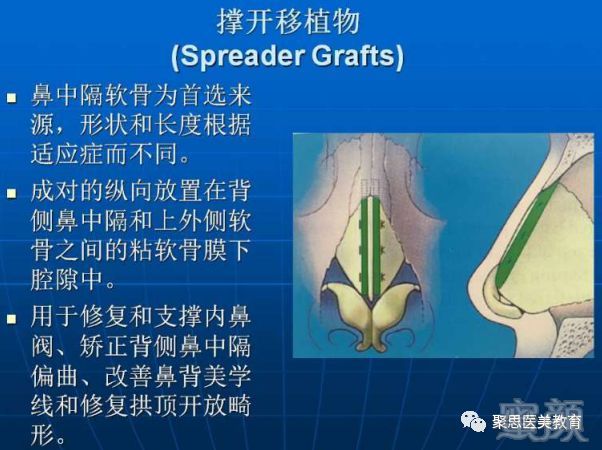 案例图片