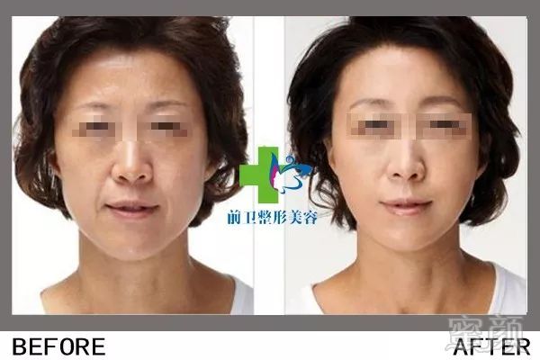 https://img.miyanlife.com/mnt/timg/190306/134KA324-9.jpg
