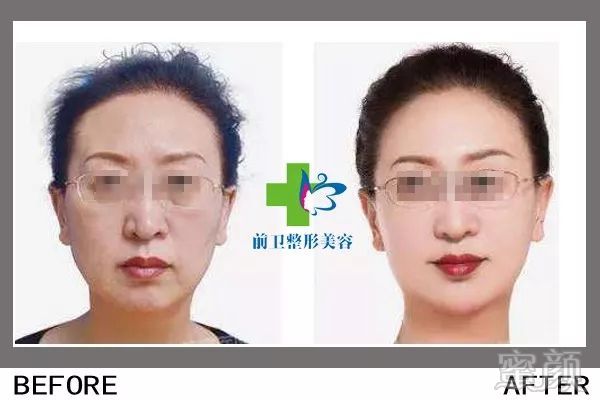 https://img.miyanlife.com/mnt/timg/190306/134KCX4-8.jpg
