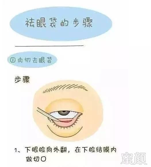 案例图片