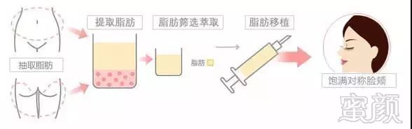 https://img.miyanlife.com/mnt/timg/190306/14453050a-2.jpg