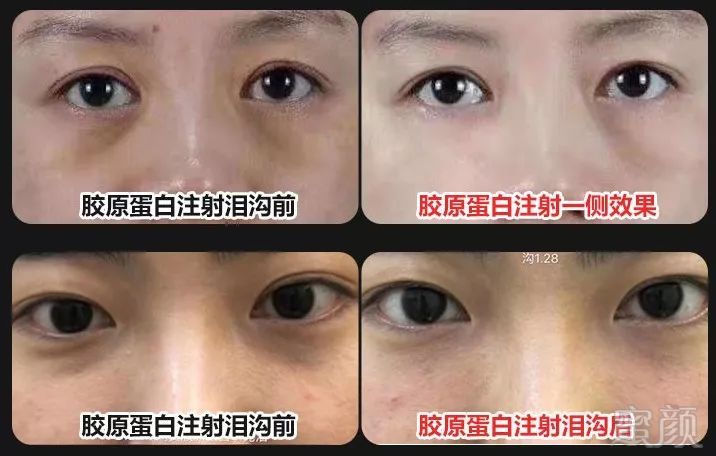 https://img.miyanlife.com/mnt/timg/190306/15051T1L-5.jpg