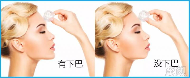 https://img.miyanlife.com/mnt/timg/190306/15120134H-3.jpg