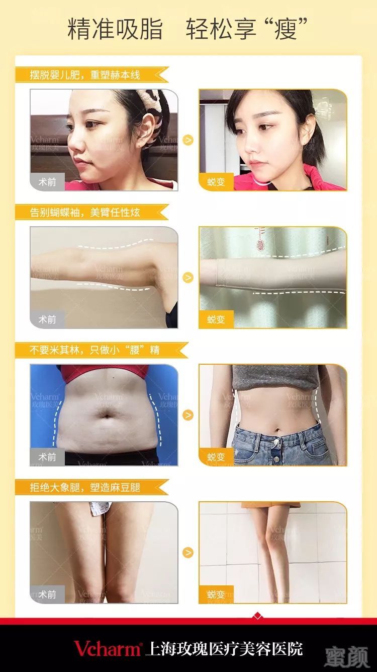 https://img.miyanlife.com/mnt/timg/190306/1512034628-5.jpg