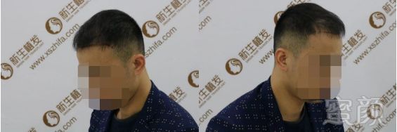 https://img.miyanlife.com/mnt/timg/190307/13241G4G-2.jpg