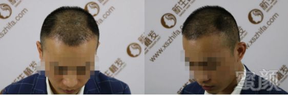 https://img.miyanlife.com/mnt/timg/190307/13241G516-5.jpg
