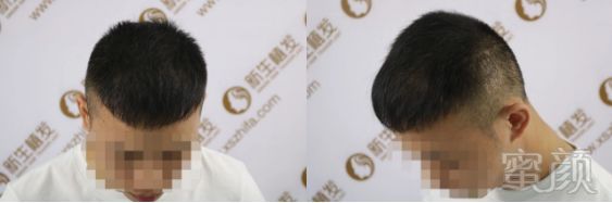 https://img.miyanlife.com/mnt/timg/190307/13241K025-7.jpg