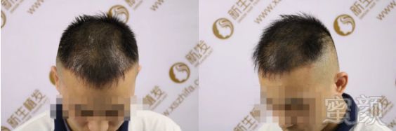 https://img.miyanlife.com/mnt/timg/190307/13241M509-6.jpg