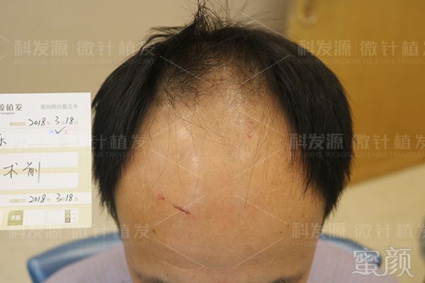 https://img.miyanlife.com/mnt/timg/190307/132F964B-15.jpg