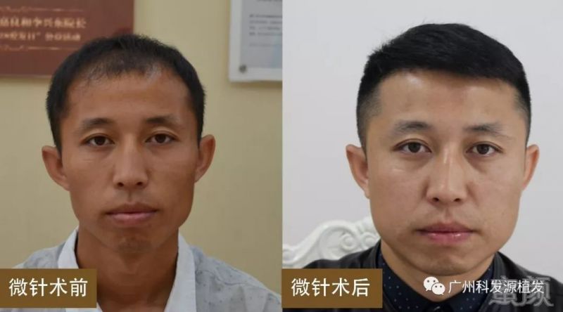 https://img.miyanlife.com/mnt/timg/190307/132FT937-10.jpg