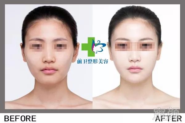 https://img.miyanlife.com/mnt/timg/190307/13402H461-10.jpg