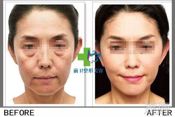 https://img.miyanlife.com/mnt/timg/190307/1340303T3-13.jpg