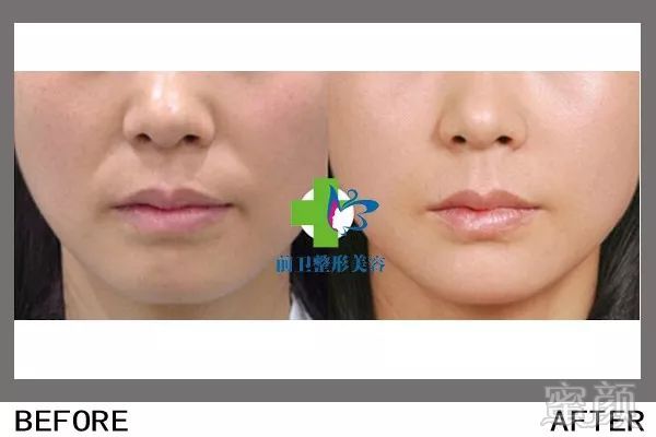 https://img.miyanlife.com/mnt/timg/190307/134031O28-15.jpg