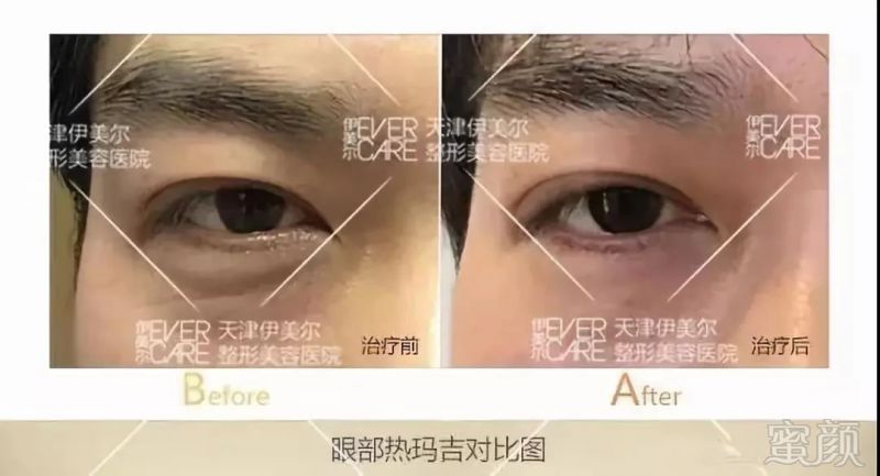 https://img.miyanlife.com/mnt/timg/190307/1342002528-6.jpg