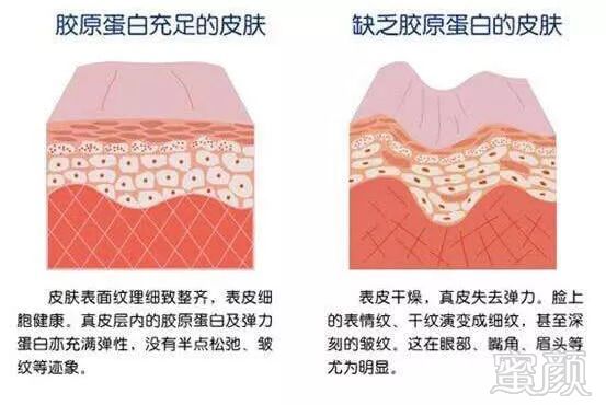 https://img.miyanlife.com/mnt/timg/190307/1456342J9-1.jpg