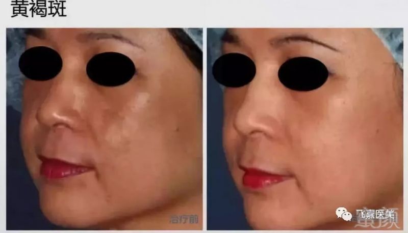https://img.miyanlife.com/mnt/timg/190308/130JG132-8.jpg