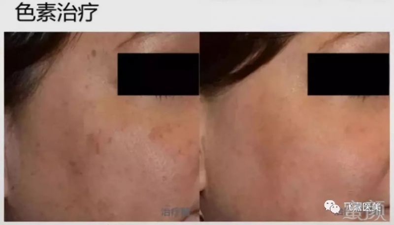 https://img.miyanlife.com/mnt/timg/190308/130JHM3-9.jpg