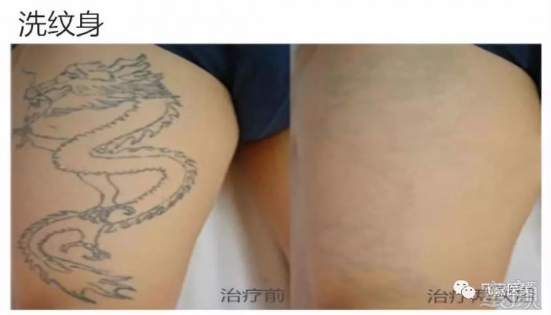https://img.miyanlife.com/mnt/timg/190308/130JJ2N-10.jpg