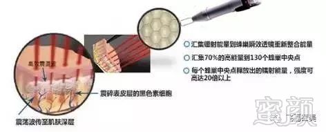 https://img.miyanlife.com/mnt/timg/190308/130JK3E-5.jpg
