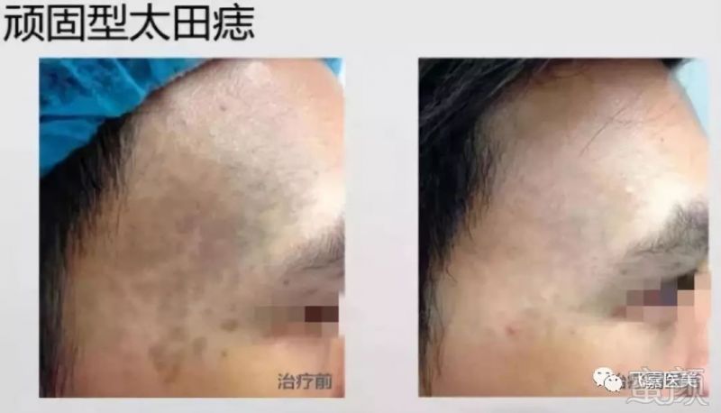 https://img.miyanlife.com/mnt/timg/190308/130JL927-7.jpg