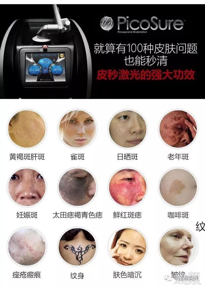 https://img.miyanlife.com/mnt/timg/190308/132001E24-1.jpg