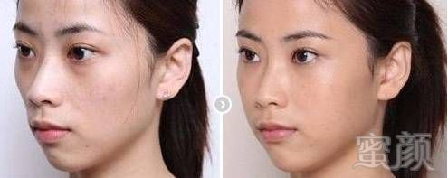https://img.miyanlife.com/mnt/timg/190308/13264240H-6.jpg