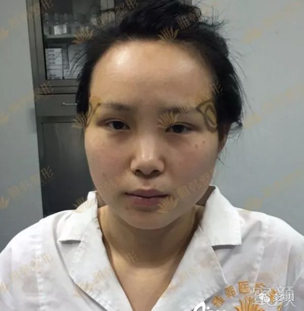 案例图片