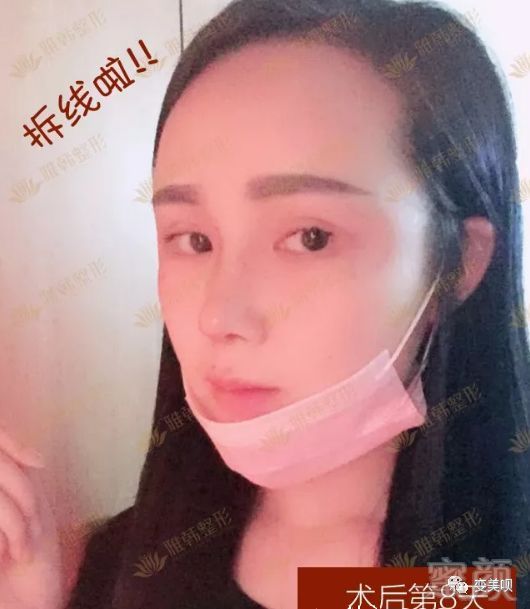 案例图片