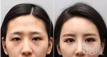 https://img.miyanlife.com/mnt/timg/190308/1431551U4-7.jpg