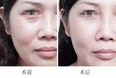 https://img.miyanlife.com/mnt/timg/190308/1431562624-8.jpg