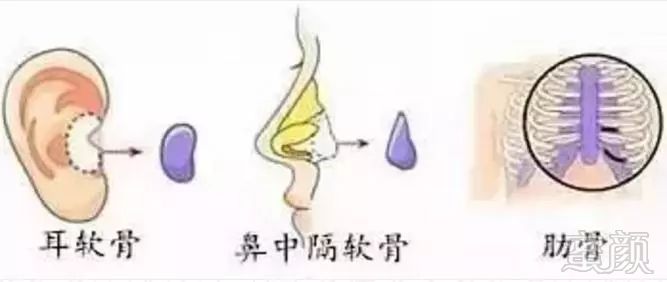 https://img.miyanlife.com/mnt/timg/190308/1432503037-2.jpg