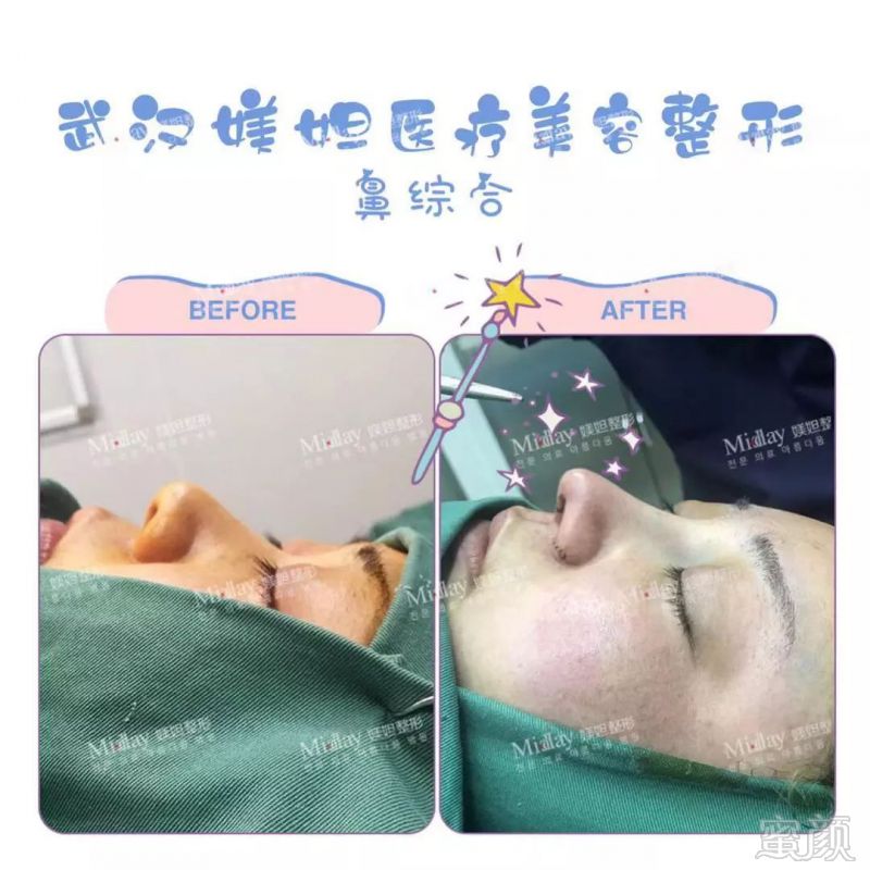 https://img.miyanlife.com/mnt/timg/190308/143250F29-3.jpg