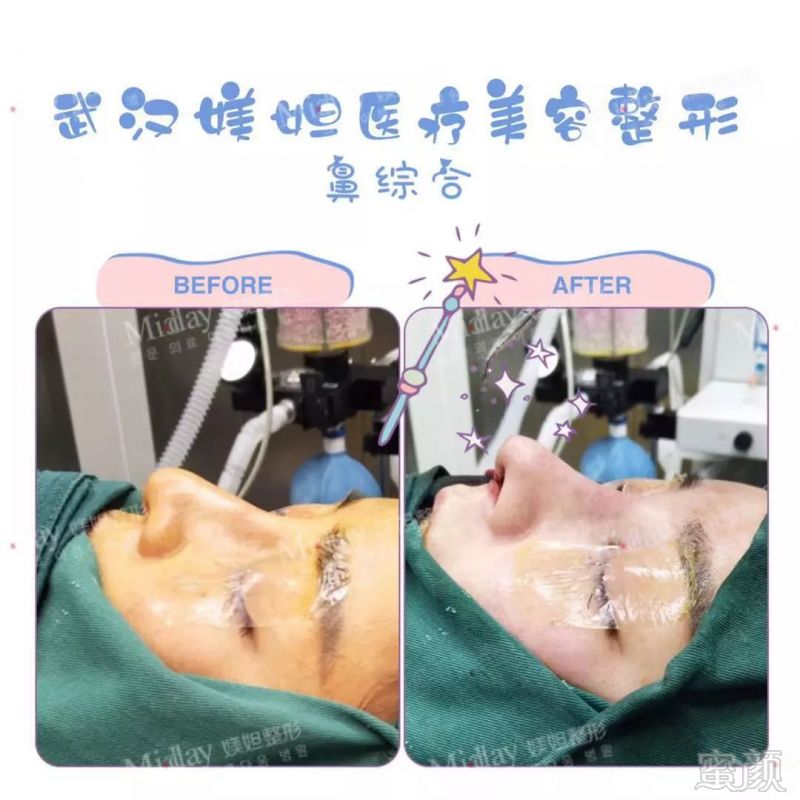 https://img.miyanlife.com/mnt/timg/190308/1432512O7-5.jpg