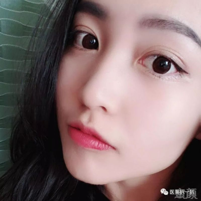 https://img.miyanlife.com/mnt/timg/190308/1435041251-2.jpg