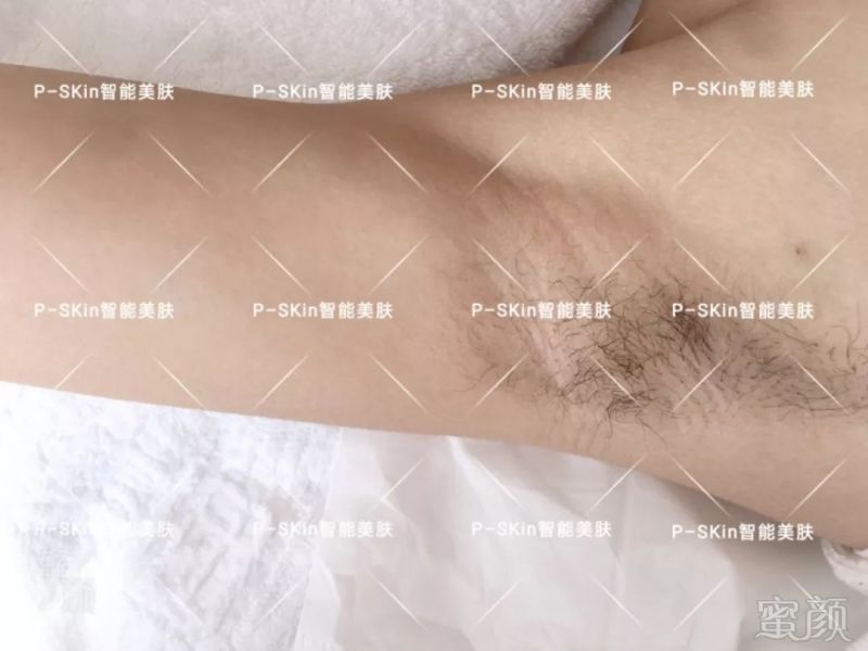 https://img.miyanlife.com/mnt/timg/190308/14415G1T-7.jpg