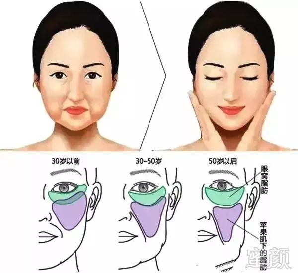https://img.miyanlife.com/mnt/timg/190308/144ZR501-3.jpg