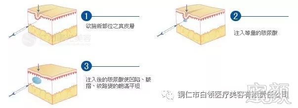 案例图片